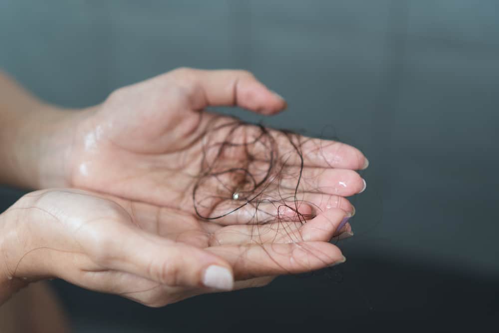 Detail Gambar Rambut Rontok Di Tangan Nomer 3