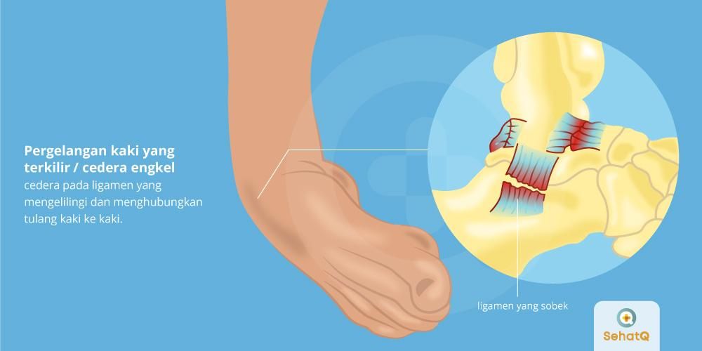 Detail Gambar Rangka Kaki Kanan Dan Kiri Nomer 18