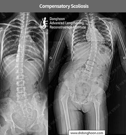 Detail Gambar Rangka Kaki Kanan Dan Kiri Nomer 52