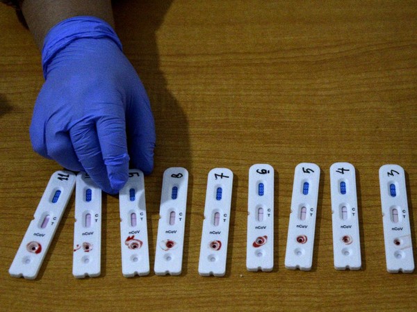 Detail Gambar Rapid Test Reaktif Nomer 12