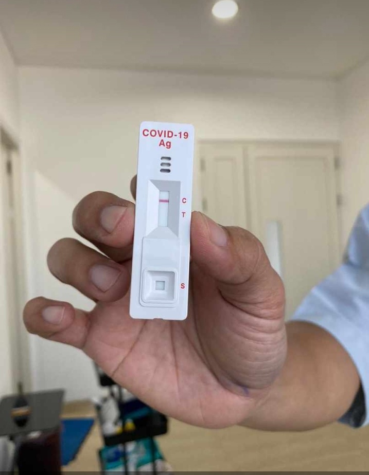 Detail Gambar Rapid Test Reaktif Nomer 15