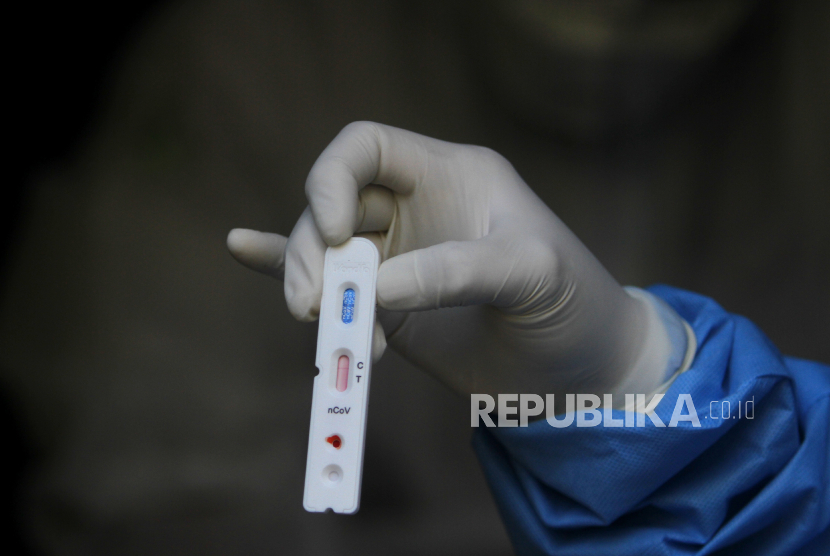 Detail Gambar Rapid Test Reaktif Nomer 19