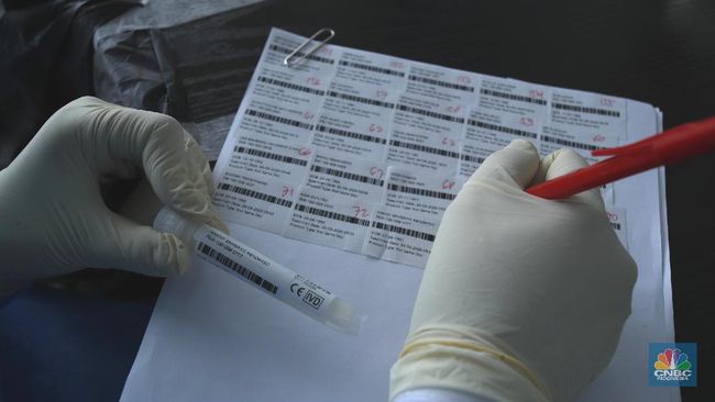 Detail Gambar Rapid Test Reaktif Nomer 23