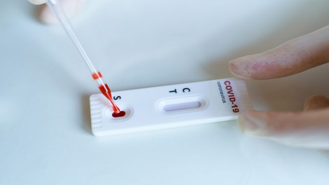 Detail Gambar Rapid Test Reaktif Nomer 24
