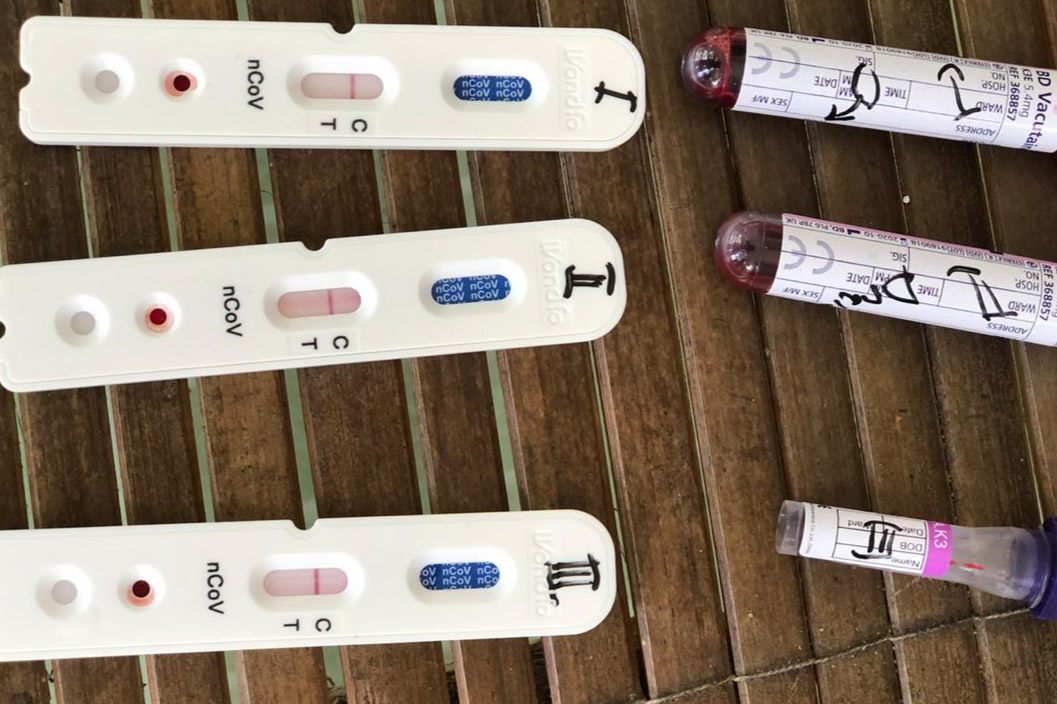 Detail Gambar Rapid Test Reaktif Nomer 6