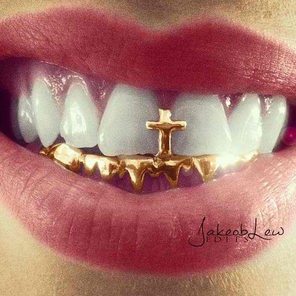 Detail Gambar Remy Gold Money Grillz Nomer 3