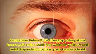 Detail Gambar Retina Mata Nomer 30