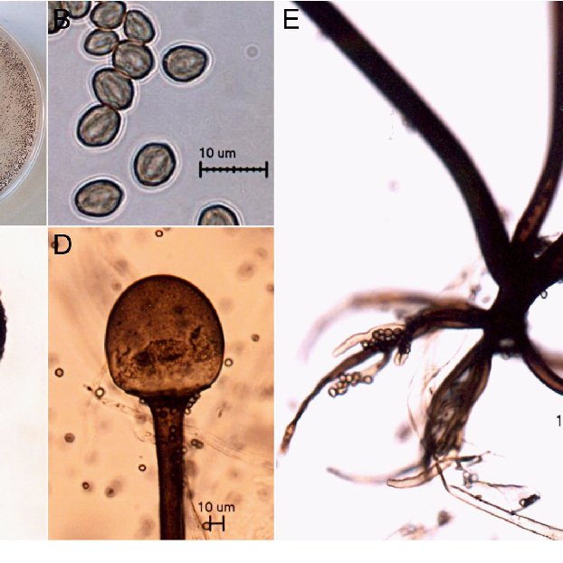 Detail Gambar Rhizopus Stolonifer Nomer 15