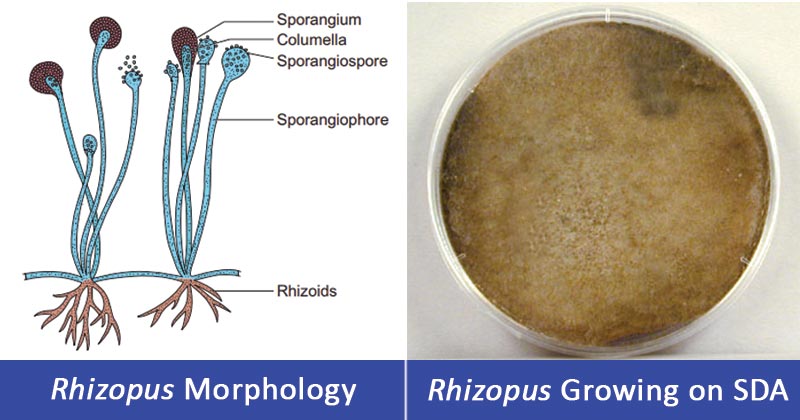 Detail Gambar Rhizopus Stolonifer Nomer 34