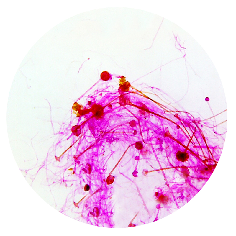 Detail Gambar Rhizopus Stolonifer Nomer 43