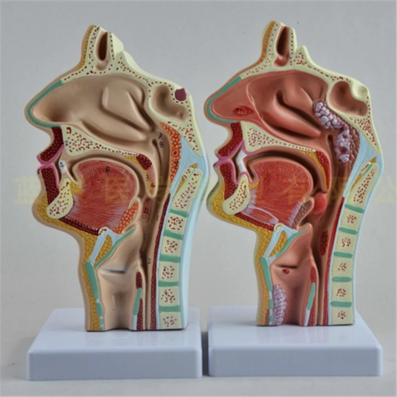 Detail Gambar Ringga Hidung Nomer 41