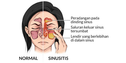 Detail Gambar Rongga Hidung Nomer 28