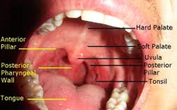 Detail Gambar Rongga Mulut Yang Sehat Nomer 2