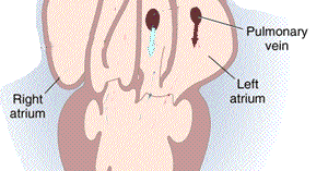 Detail Gambar Ruang Jantung Nomer 39