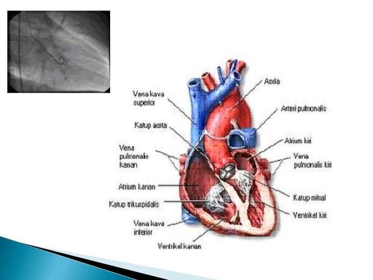 Detail Gambar Ruang Jantung Nomer 55