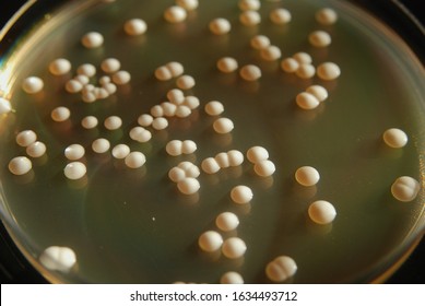 Detail Gambar Saccharomyces Cerevisiae Nomer 16