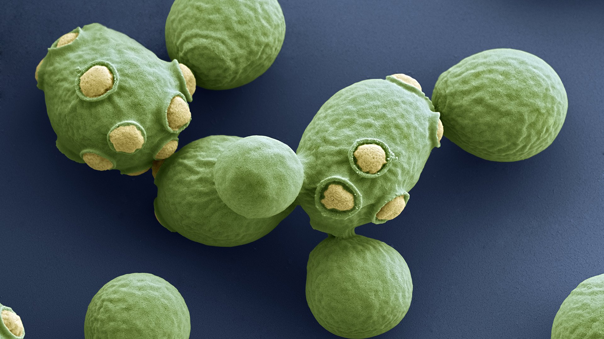 Detail Gambar Saccharomyces Cerevisiae Nomer 3