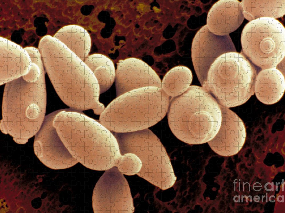 Detail Gambar Saccharomyces Cerevisiae Nomer 45