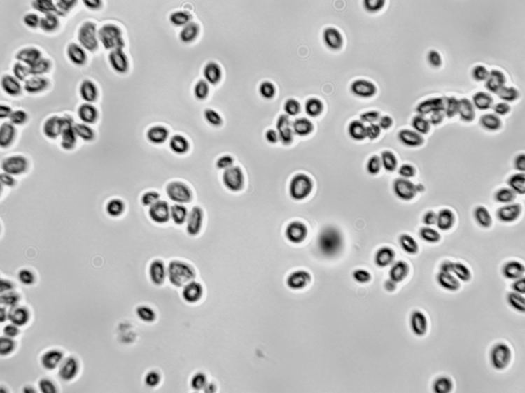 Detail Gambar Saccharomyces Cerevisiae Nomer 50