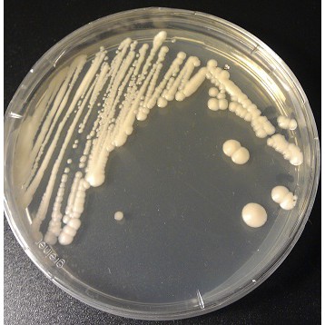 Detail Gambar Saccharomyces Serevisiae Pada Cawan Petri Nomer 8