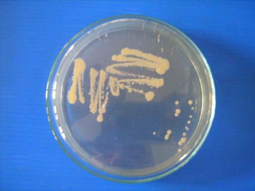 Detail Gambar Saccharomyces Serevisiae Pada Cawan Petri Nomer 11