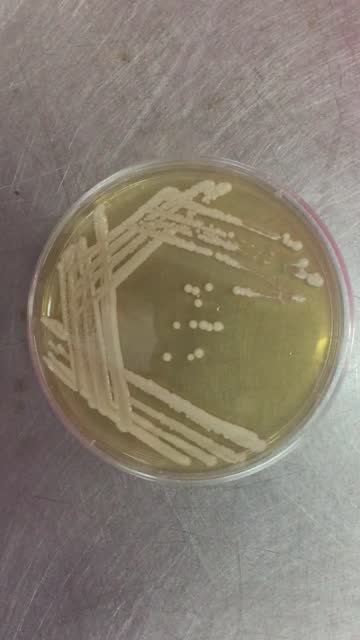 Detail Gambar Saccharomyces Serevisiae Pada Cawan Petri Nomer 14