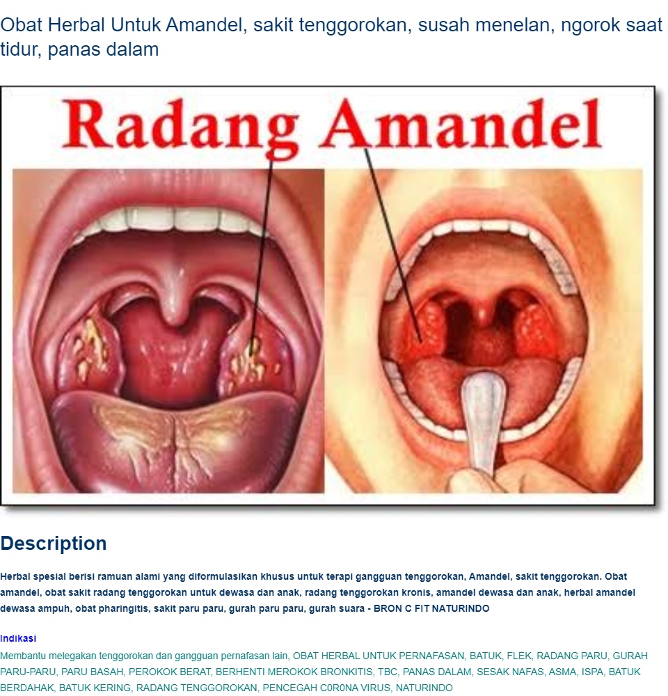 Detail Gambar Sakit Amandel Nomer 24