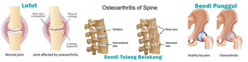 Detail Gambar Sakit Perut Haid Nomer 27