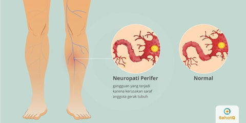 Detail Gambar Saraf Di Kaki Nomer 44