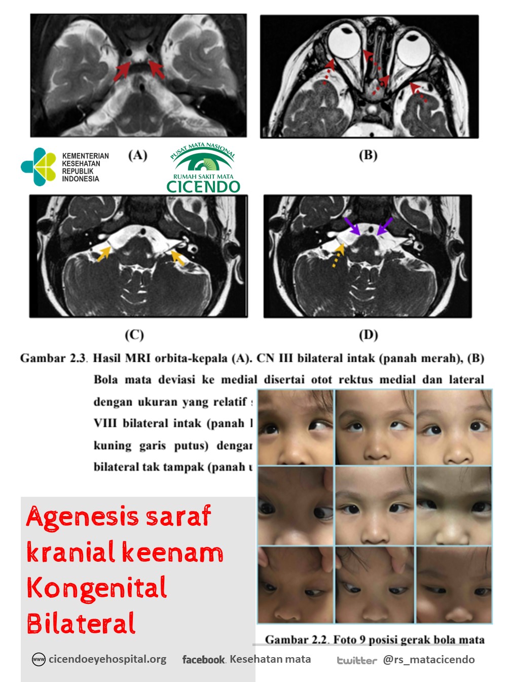 Detail Gambar Saraf Kranial Nomer 37