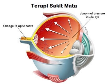 Detail Gambar Saraf Mata Nomer 53