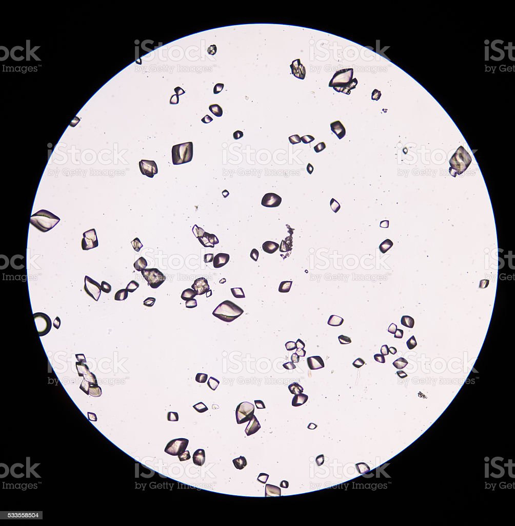 Detail Gambar Sedimen Urin Nomer 10