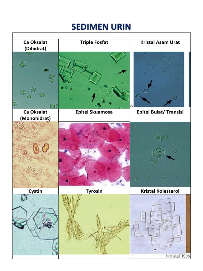 Detail Gambar Sedimen Urin Nomer 20