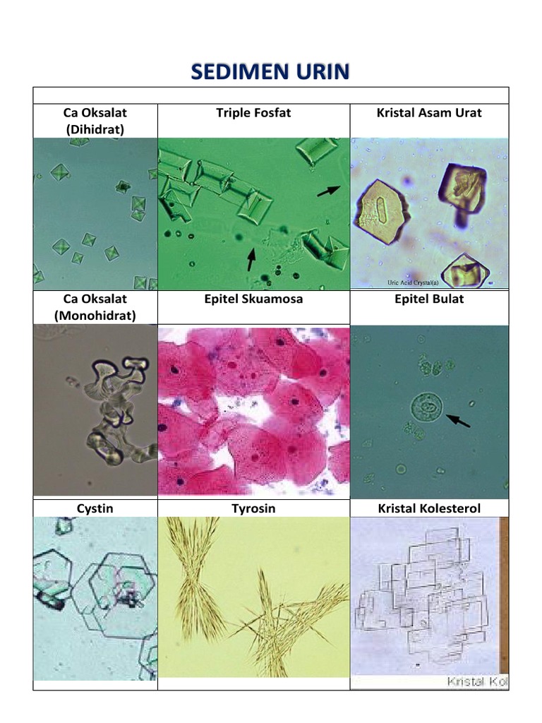 Detail Gambar Sedimen Urin Nomer 3