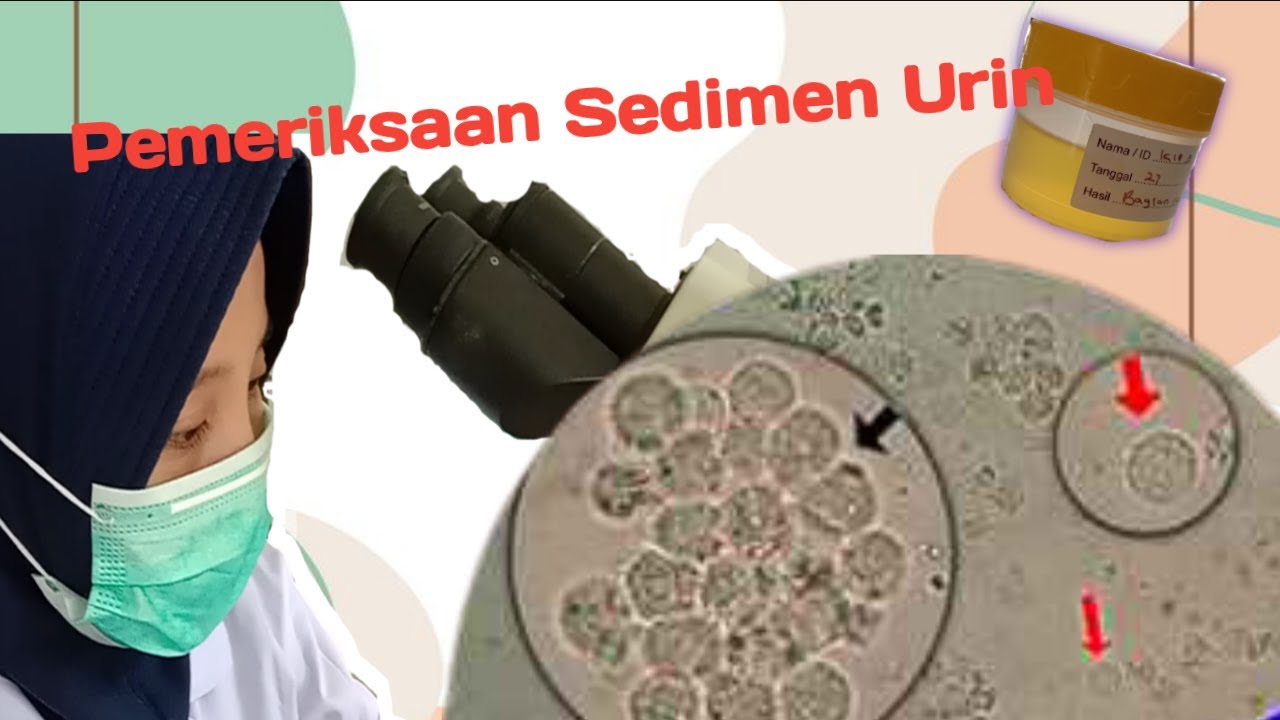 Detail Gambar Sedimen Urin Nomer 35