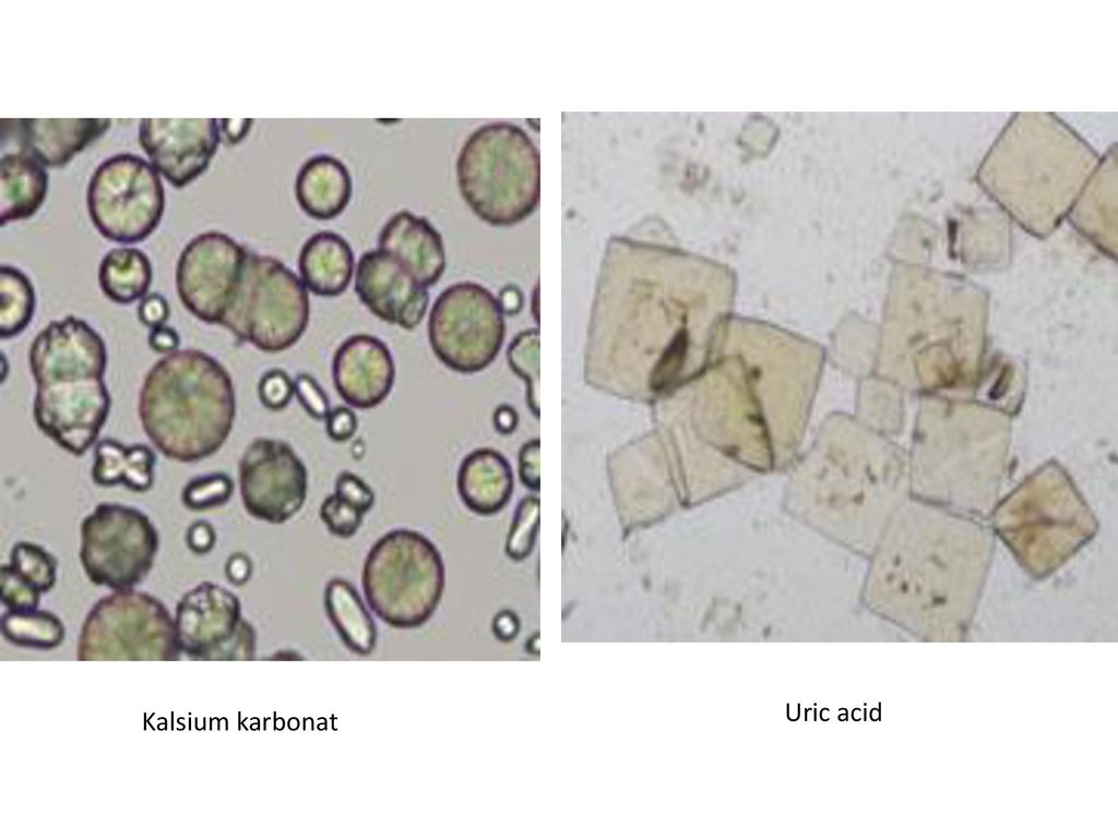 Detail Gambar Sedimen Urin Nomer 40