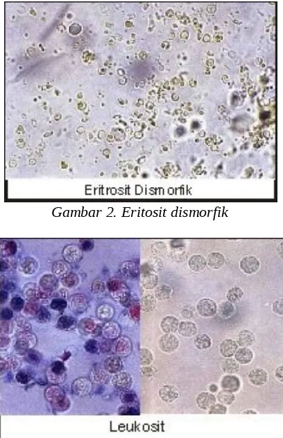 Detail Gambar Sedimen Urin Nomer 5