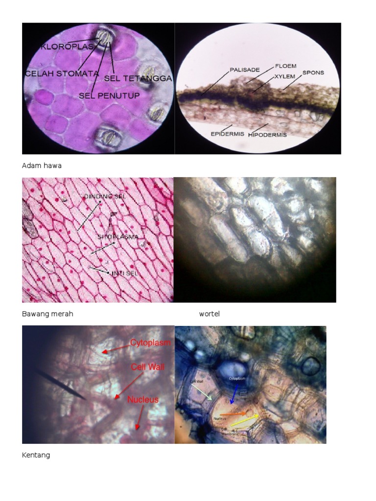 Detail Gambar Sel Adam Hawa Nomer 10