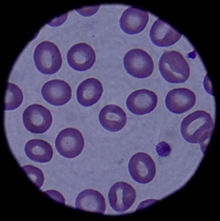 Detail Gambar Sel Darah Merah Dan Putih Nomer 43