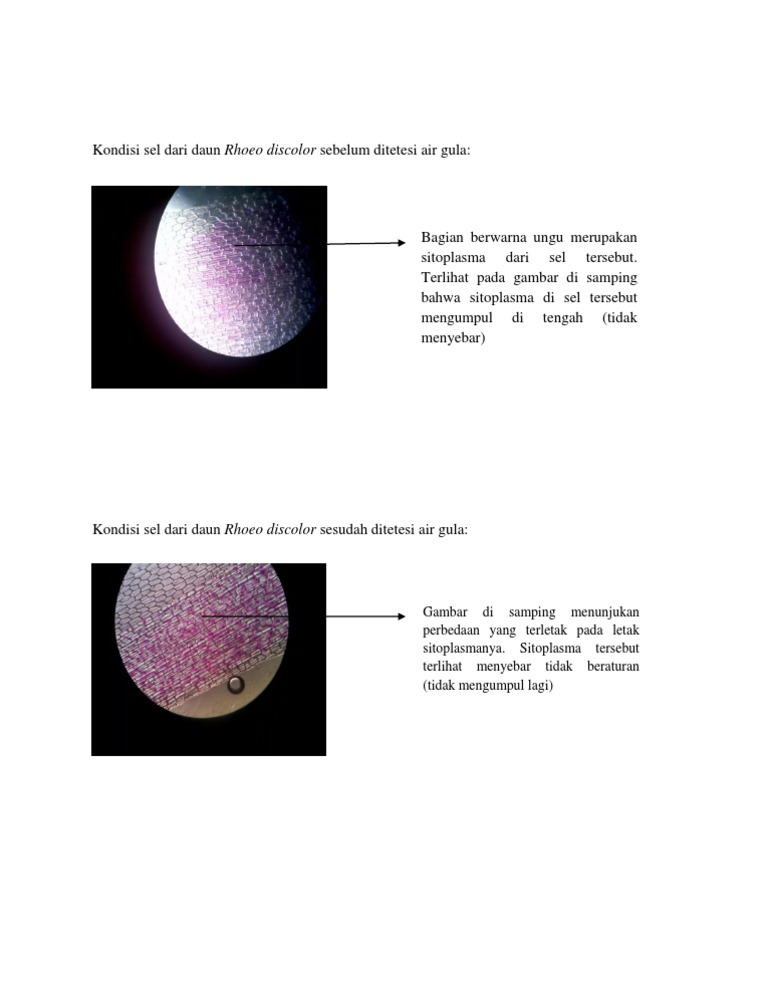 Detail Gambar Sel Daun Rhoeo Discolor Nomer 28