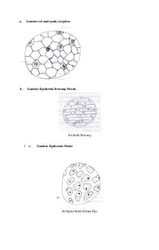 Detail Gambar Sel Gabus Ketela Pohon Nomer 29