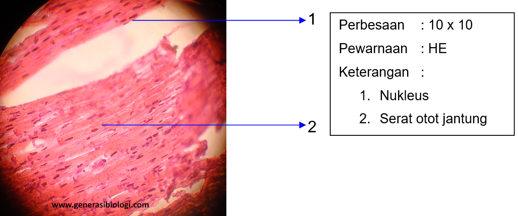 Detail Gambar Sel Otot Jantung Nomer 29