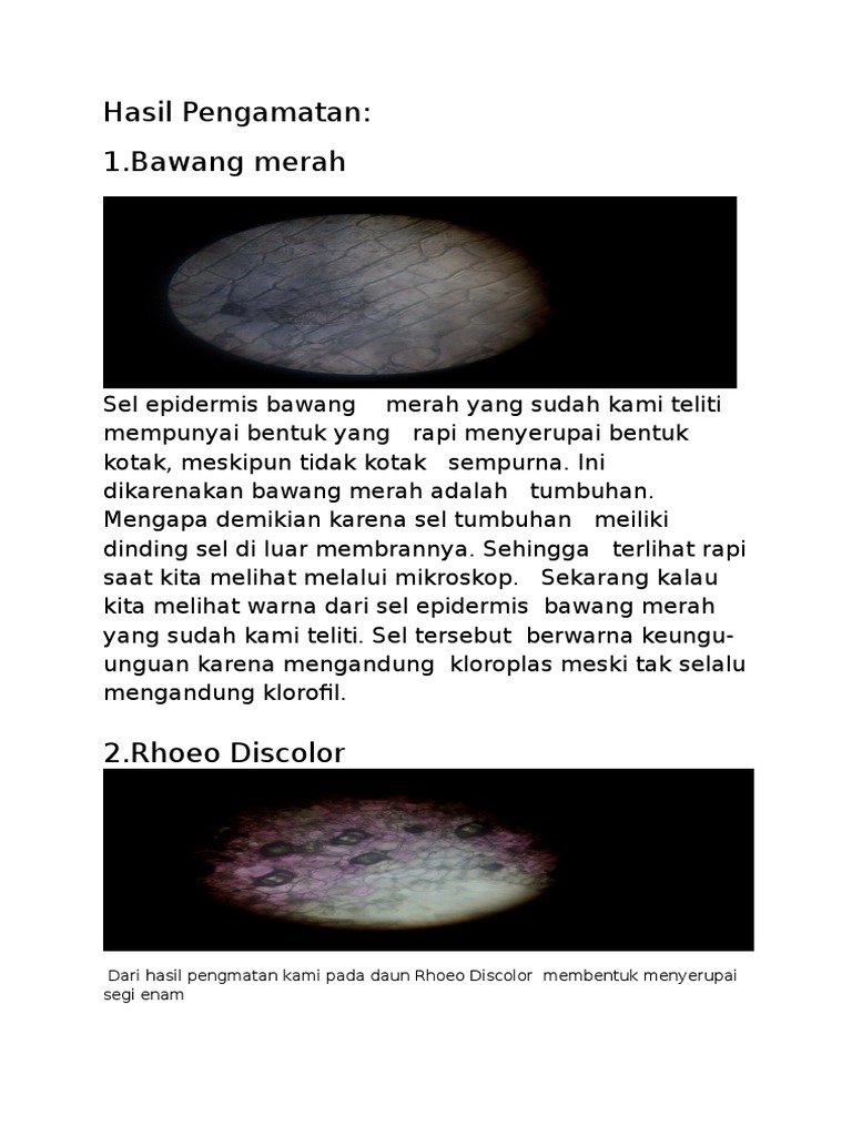 Detail Gambar Sel Pada Bawang Merah Nomer 47