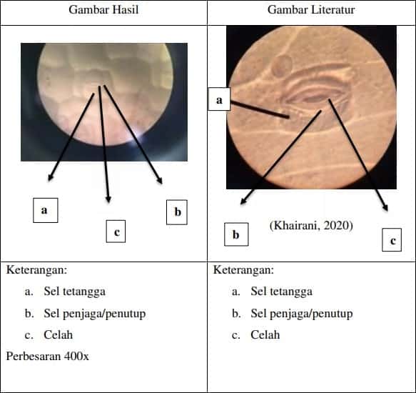 Detail Gambar Sel Pada Daun Rhoeo Discolor Nomer 30