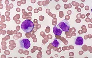 Detail Gambar Sel Sel Darah Nomer 29