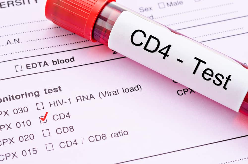 Detail Gambar Sel Yang Terinfeksi Hiv Nomer 19