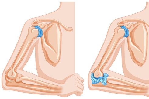 Detail Gambar Sendi Antara Tulang Siku Nomer 7