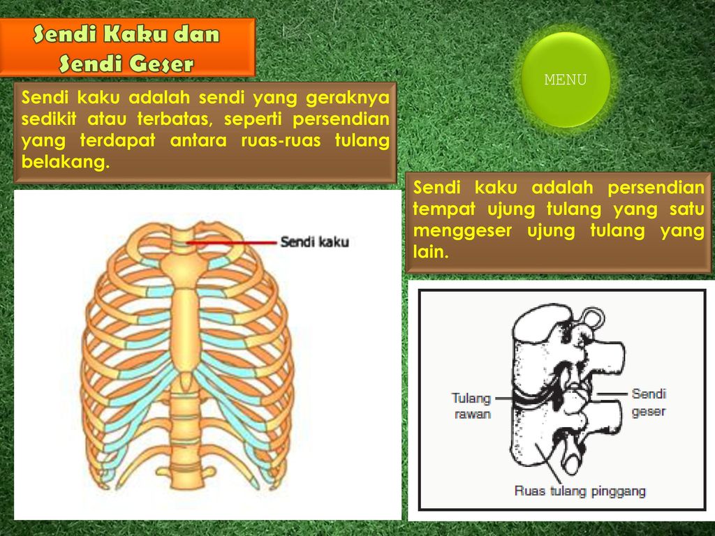 Detail Gambar Sendi Kaku Nomer 30