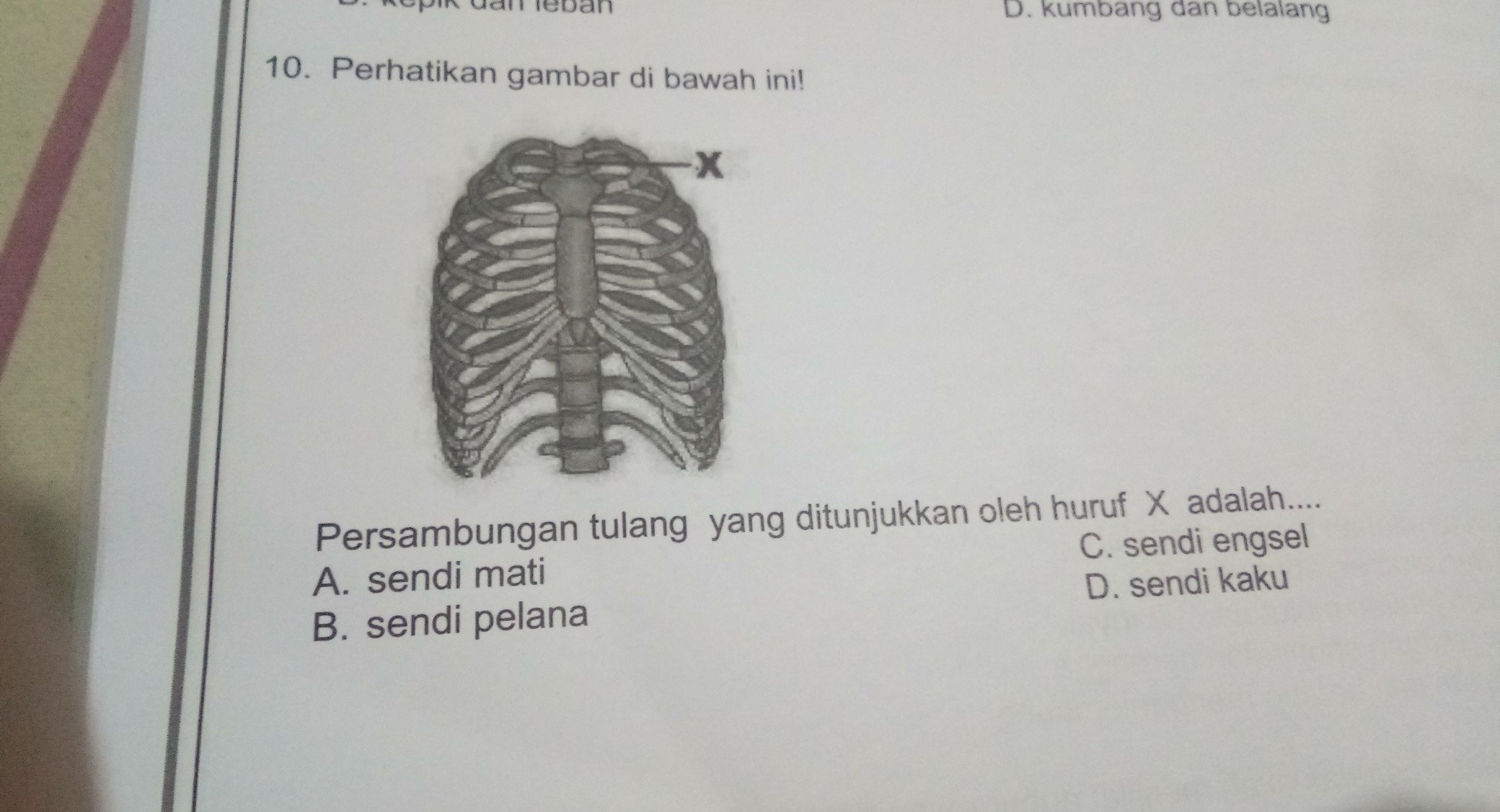 Detail Gambar Sendi Kaku Nomer 40