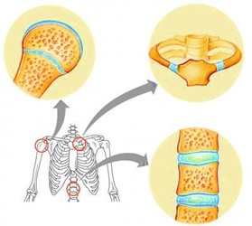 Detail Gambar Sendi Kaku Nomer 8